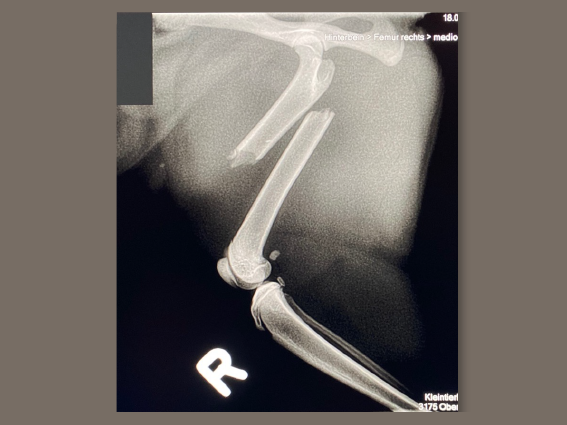 Röntgenbild zeigt eine Knochenfraktur