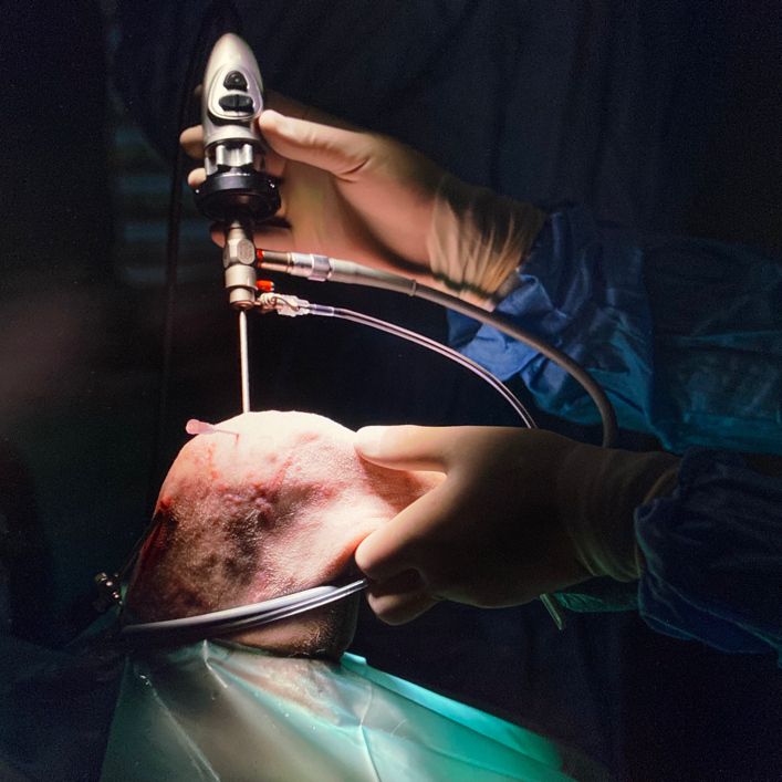 Der Chirurg hält das Arthroskopie Werkzeug in der Hand